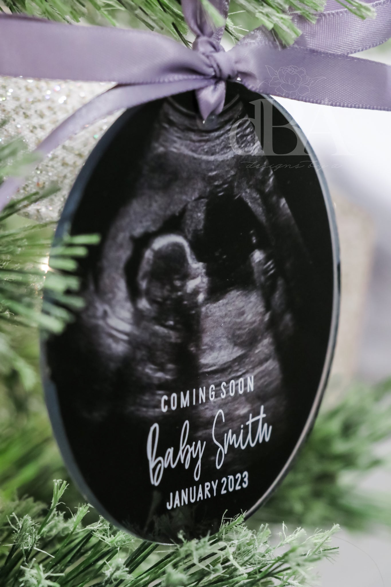 Ultrasound Christmas Ornament- UV Printed