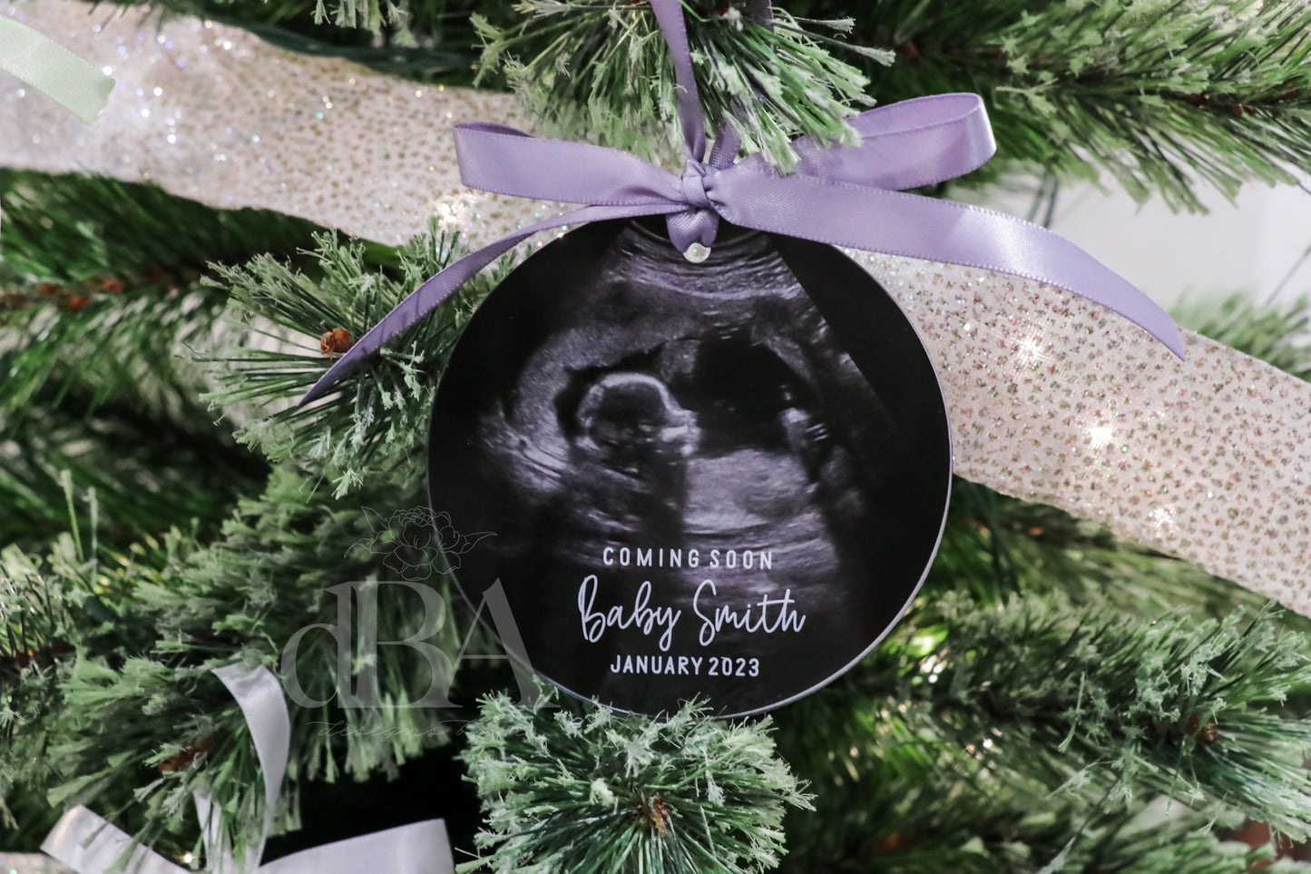 Ultrasound Christmas Ornament- UV Printed